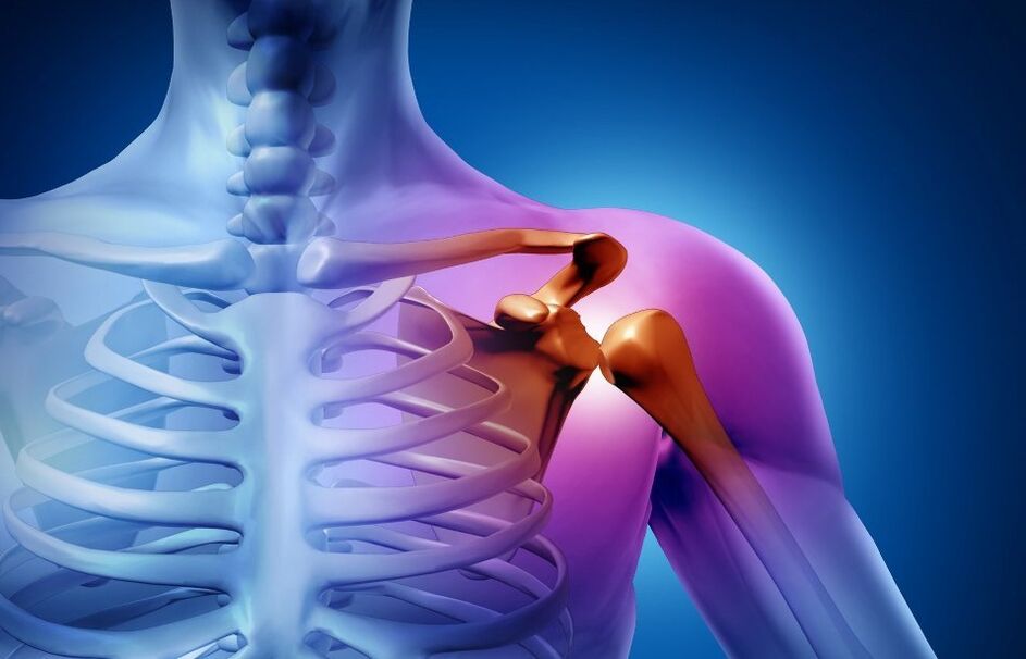 Lesiones de hombro causadas por artropatía